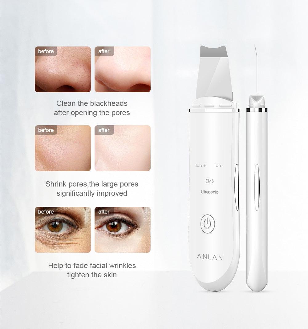 ANLAN Skin Scrubber Pro - Online Beauty Cart