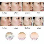Clarity Restore Blemish & Scar Essence Oil
